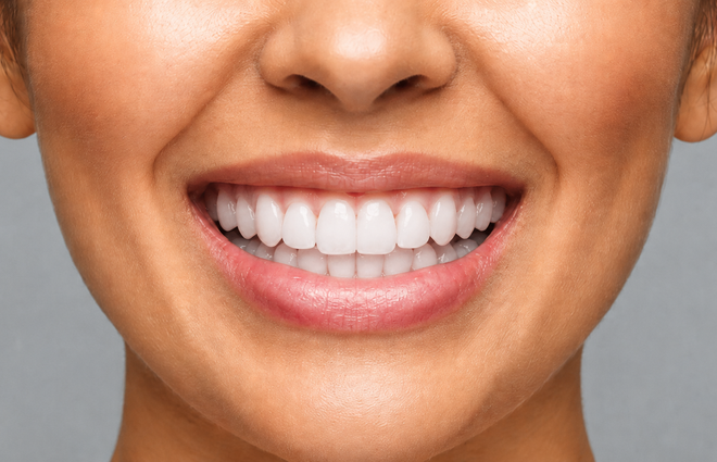 Smile after dental treatment